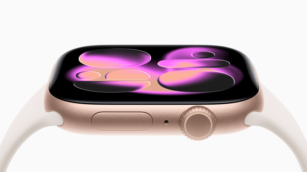 Schuin zijaanzicht van Apple Watch Series 11.